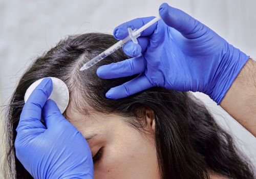 Chemical Heel Peel Treatment