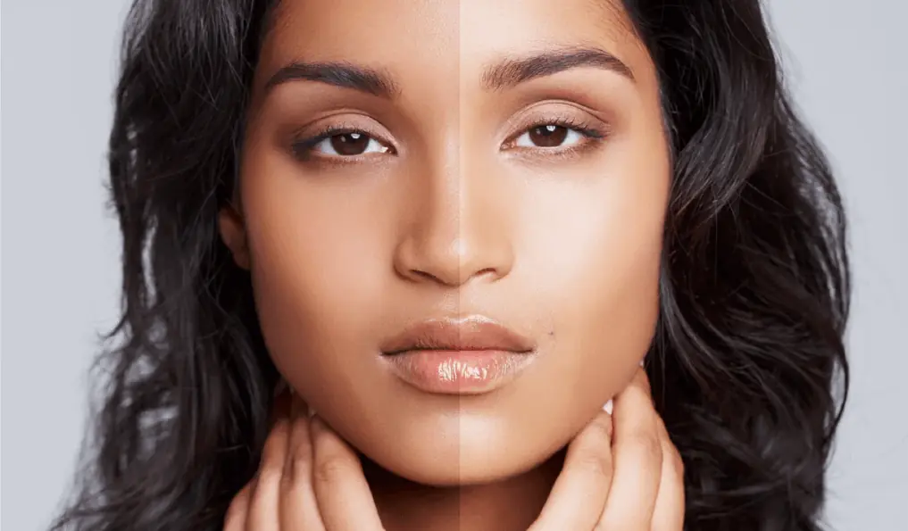 Pigmentation & Tan Removal