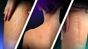 Nail Care & Cuticle Treatment